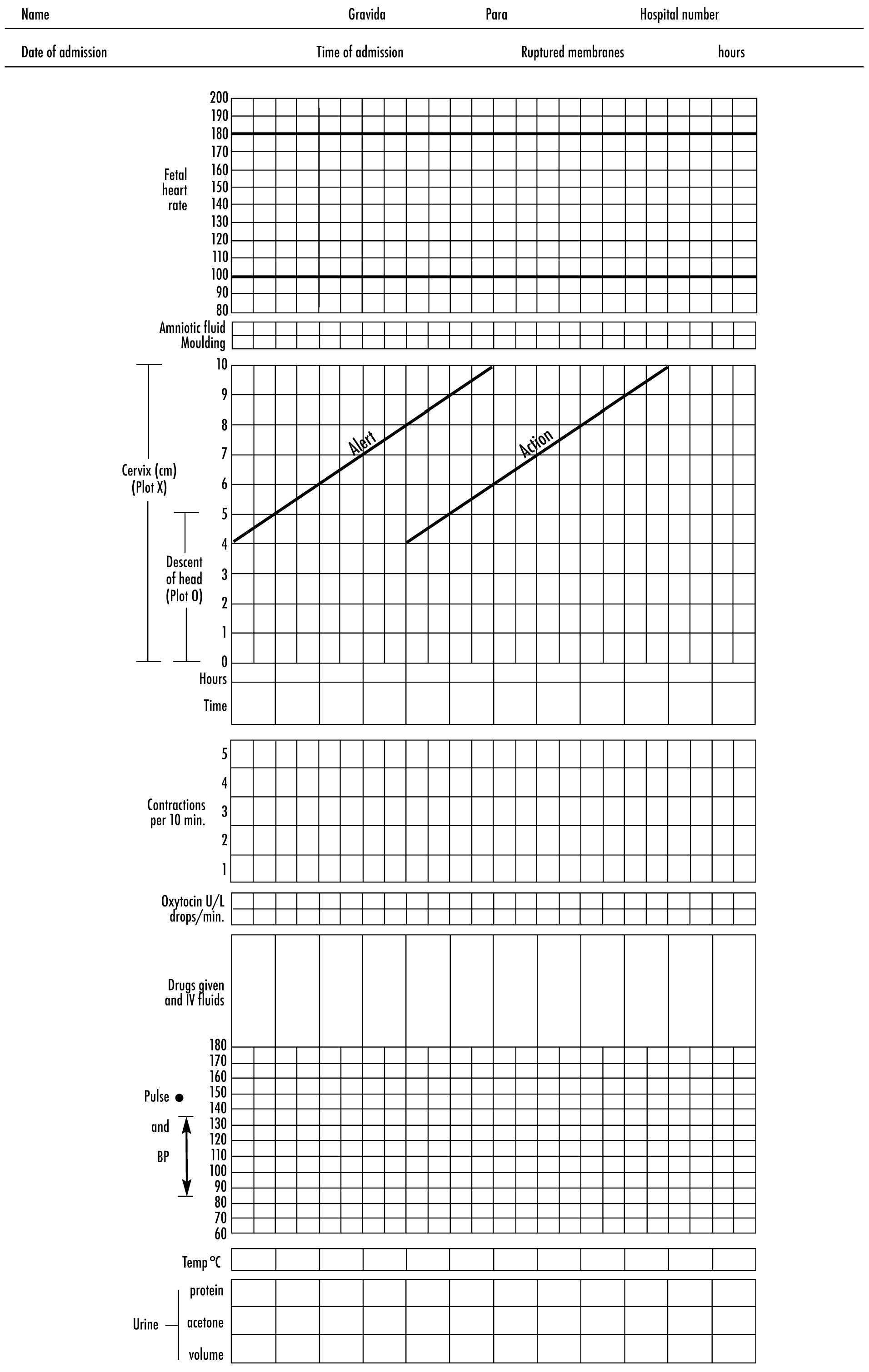 Partograph Chart