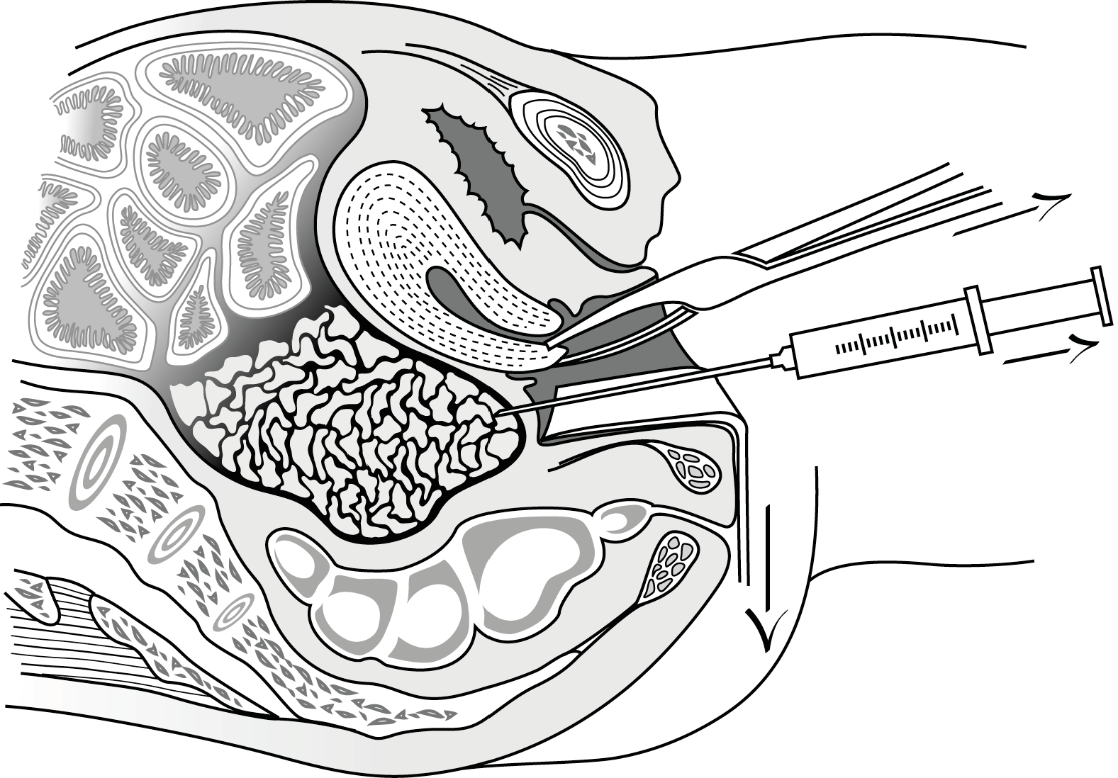 What is spotting? Spotting vs. period, The Fornix